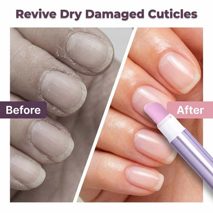 StrongNail™ - علاج الأظافر والجلد المحيط بها