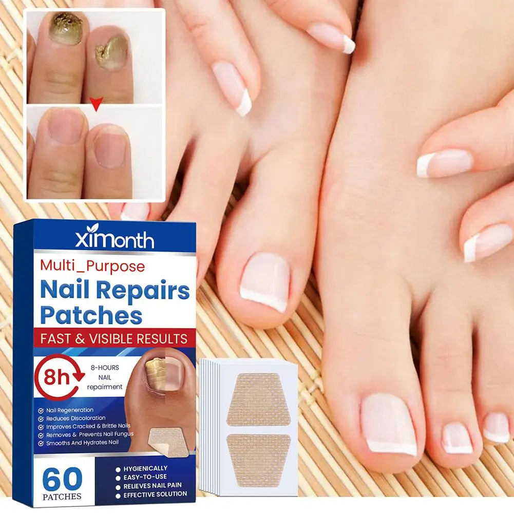 HealthyNail™ náplasti na obnovu plesňových nechtov - Diskrétne obnovte čisté, zdravé nechty