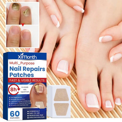 HealthyNail™ náplasti na obnovu plesňových nechtov - Diskrétne obnovte čisté, zdravé nechty
