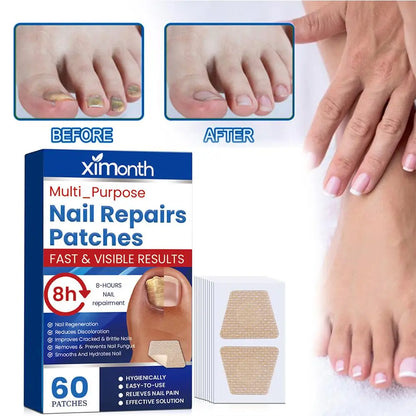 HealthyNail™ náplasti na obnovu plesňových nechtov - Diskrétne obnovte čisté, zdravé nechty