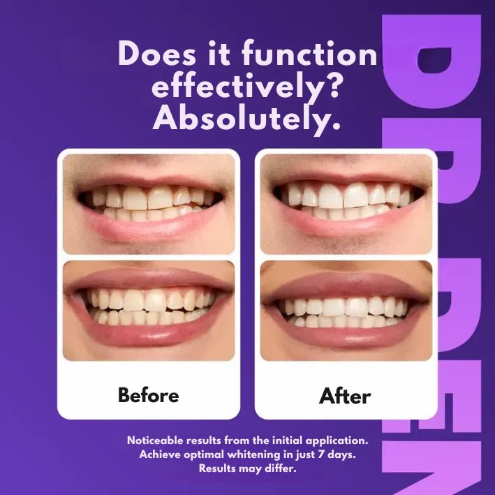 TrueWhite™ - A perfect smile in just 30 minutes - BrinoaTrueWhite™ - A perfect smile in just 30 minutesTrueWhite™ - A perfect smile in just 30 minutes